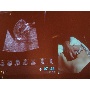 MSZNUT 2011. Pécs - Live Scanning 7.