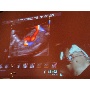 MSZNUT 2011. Pécs - Live Scanning 8.