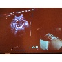 MSZNUT 2011. Pécs - Live Scanning 11.