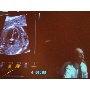 MSZNUT 2011. Pécs - Live Scanning 19.