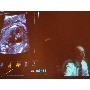 MSZNUT 2011. Pécs - Live Scanning 20.