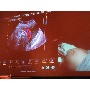 MSZNUT 2011. Pécs - Live Scanning 25.