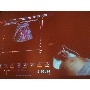 MSZNUT 2011. Pécs - Live Scanning 29.