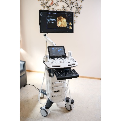 Használt HS40 ultrahang készülék 3D/4D/5D hasi vizsgálófejjel