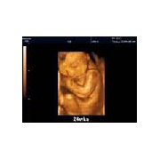 3D/4D Rendelők II. Találkozója - 3D/ 4D Ultrahang Rendelők II. Találkozója Alma Beauty Centrumok I. Találkozója